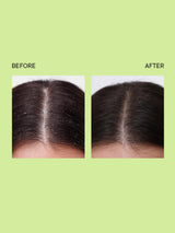 Quench Dandruff Control Hair Serum - 100ml - 5