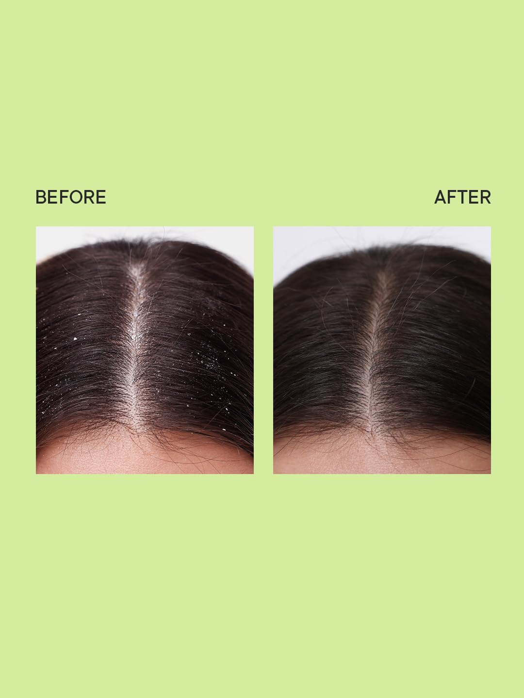 Quench Dandruff Control Hair Serum - 100ml - 5
